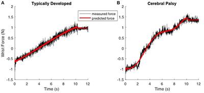 Forearm Flexor Muscles in Children with Cerebral Palsy Are Weak, Thin and Stiff